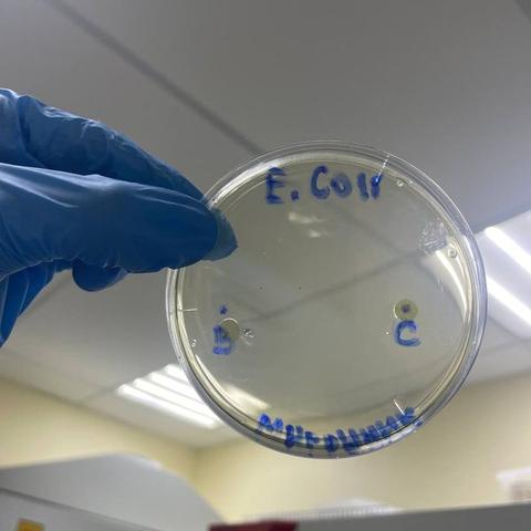 Petri dish with E. coli culture showing antibacterial inhibition zones around the extract discs