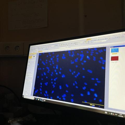 Fluorescent microscopy image of DAPI-stained cell nuclei