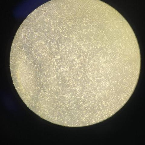 Phase-contrast microscopy view of cultured MenSC cells